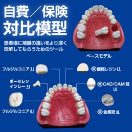 患者説明用模型